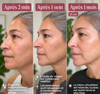Facial lymphatic brush